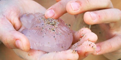 Puntura di medusa: cosa fare e cosa evitare per i bambini